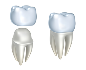 diagram of tooth and crown assembly Greenville, NC